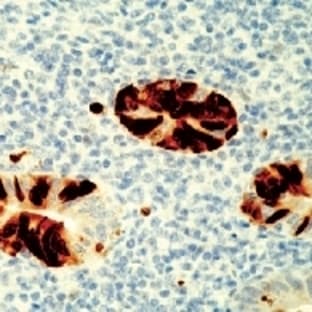 anti-Adenovirus Type 2 antibody avatar