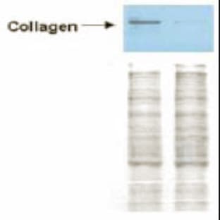 anti-Collagen, Type I (COL1) antibody avatar