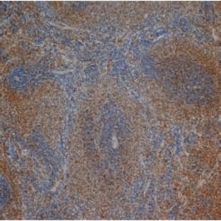 anti-CD3 delta Chain antibody avatar
