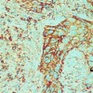 anti-CD44std antibody avatar