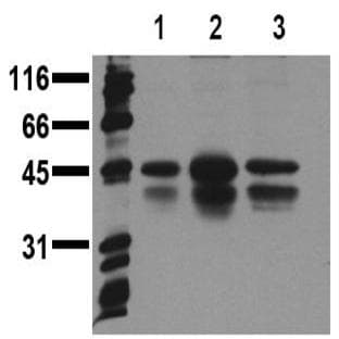 anti-CREB + ATF1 (pSer133) antibody avatar