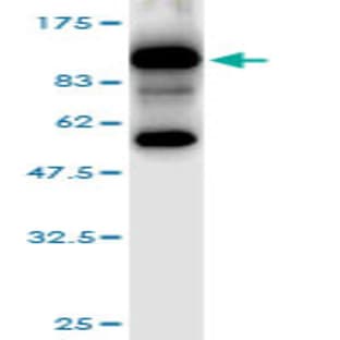anti-Hemagglutinin (HA) (AA 17-531) antibody avatar