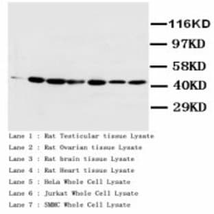 anti-Actin (AA 367-377) antibody avatar