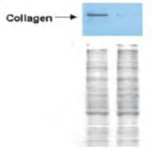 anti-Collagen, Type I (COL1) antibody avatar