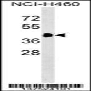 anti-ACTA1/alpha-Actin (C-Term), (AA 189-217) antibody