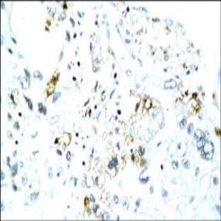 anti-Core (N-Term) antibody avatar