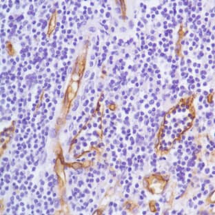 anti-CD34 (Endothelial Cell Marker) antibody avatar