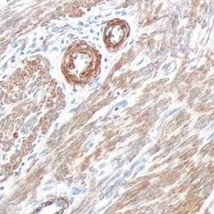 anti-Actin-Smooth Muscle (SMA) (N-Term) antibody avatar