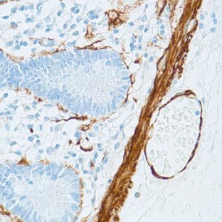 anti-Actin-Smooth Muscle (N-Term) antibody avatar