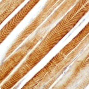 anti-Actin-Skeletal Muscle (N-Term) antibody avatar