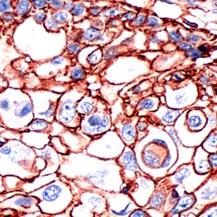 anti-CD44std antibody avatar