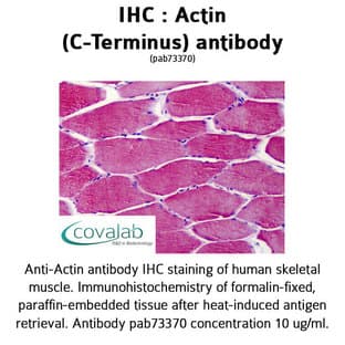 anti-Actin (C-Term) antibody avatar