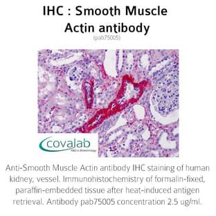 anti-Actin, alpha 2, Smooth Muscle, Aorta (ACTA2) (N-Term) antibody avatar