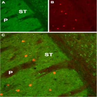 anti-Cholinergic Receptor, Muscarinic 1 (CHRM1) (AA 227-353), (Intracellular) antibody avatar