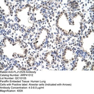 anti-Cleavage and Polyadenylation Specificity Factor Subunit 7 (FLJ12529) (C-Term) antibody avatar