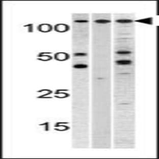 anti-Chromosome Segregation 1-Like (S. Cerevisiae) (CSE1L) (C-Term), (AA 55-84) antibody avatar