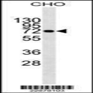 anti-AchE (C-Term), (AA 582-610) antibody avatar