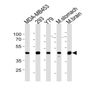anti-Creatine Kinase BB (Center) antibody avatar