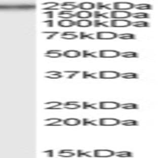 anti-Collagen, Type VII (COL7) antibody avatar