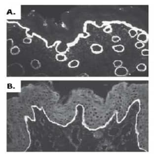 anti-Collagen, Type VII (COL7) (AA 97-200), (AA 479-578), (AA 757-967) antibody avatar