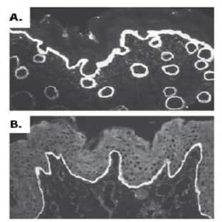 anti-Collagen, Type VII (COL7) (AA 97-200), (AA 479-578), (AA 757-967) antibody avatar