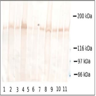 anti-Collagen Type XVII alpha 1 Chain (AA 1-490), (AA 1-452), (Chain alpha 1), (N-Term) antibody avatar