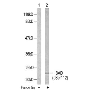 anti-Bcl-2-Like 8 (pSer112), (pSer75) antibody avatar