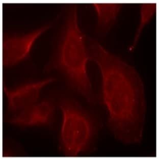anti-Bcl-2-Like 11 (pSer69), (pSer65) antibody avatar