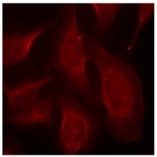 anti-Bcl-2-Like 11 (pSer69), (pSer65) antibody avatar