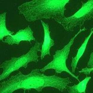 anti-alpha Tubulin / TUBA4A / TUBA1 (N-Term) antibody