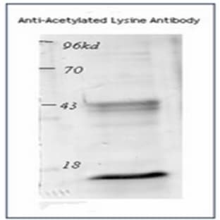 anti-Acetylated Lysine antibody avatar
