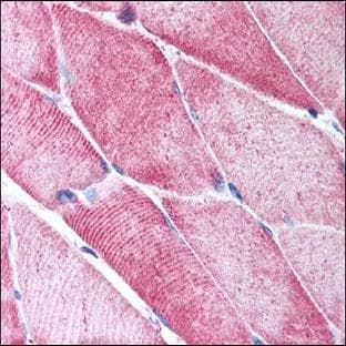 anti-ACTA2 / Aortic Smooth Muscle Actin (N-Term) antibody