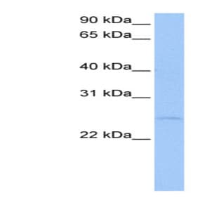 anti-CTA-126B4.3 (N-Term) antibody avatar