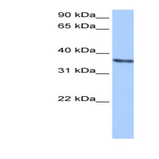 anti-Chondroadherin (CHAD) (Middle Region) antibody avatar