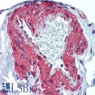 anti-Actin, alpha 2, Smooth Muscle, Aorta (ACTA2) (N-Term) antibody avatar
