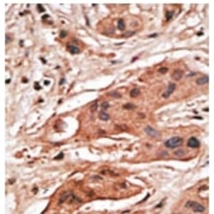 anti-Bcl-2-Like 5 (N-Term), (BH3 Domain) antibody avatar