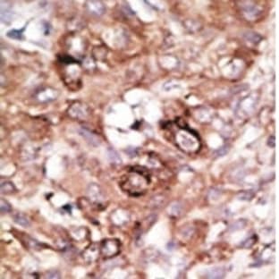 anti-Bcl-2-Like 8 (AA 100-130), (BH3 Domain) antibody avatar