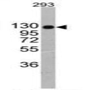 anti-Collagen Type II alpha 1 Chain (C-Term), (Chain alpha 1) antibody avatar