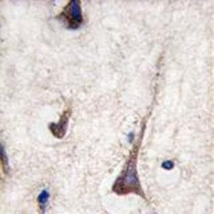 anti-CD3 gamma Chain (N-Term), (Chain gamma) antibody avatar