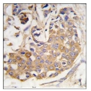 anti-Collagen Type IX (Chain alpha 1) antibody avatar