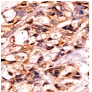 anti-Bcl-2-Like 8 (pSer118) antibody