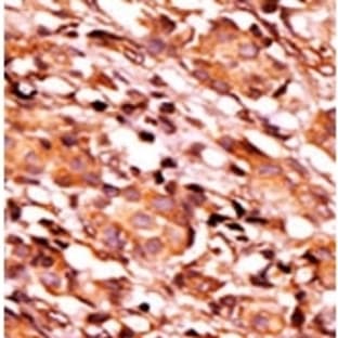 anti-Bcl-2-Like 8 (pSer134) antibody avatar