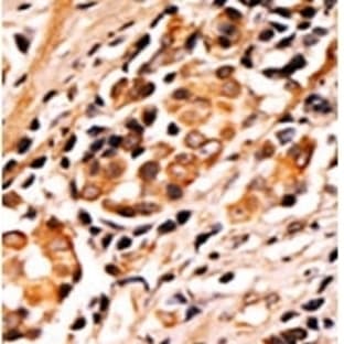 anti-Bcl-2-Like 8 (pSer75) antibody
