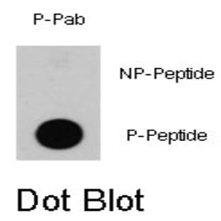 anti-B-Raf Proto-Oncogene (pThr598) antibody avatar