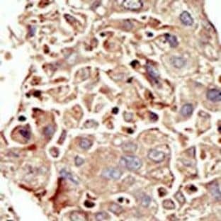 anti-Activin Receptor Type 1 (ACRV1) (Middle Region) antibody avatar