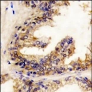 anti-B-Raf Proto-Oncogene (Middle Region) antibody avatar