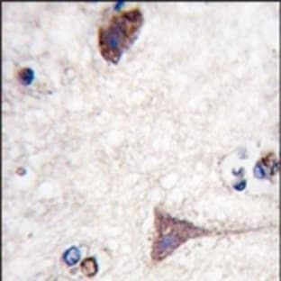 anti-B-Raf Proto-Oncogene (Thr400) antibody avatar