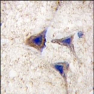 anti-B-Raf Proto-Oncogene (Ser445) antibody avatar