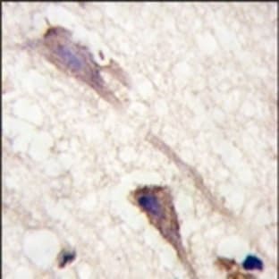 anti-B-Raf Proto-Oncogene (Ser601) antibody avatar