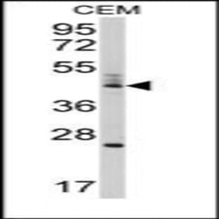 anti-Bcl-2-Like 13 (Middle Region) antibody avatar